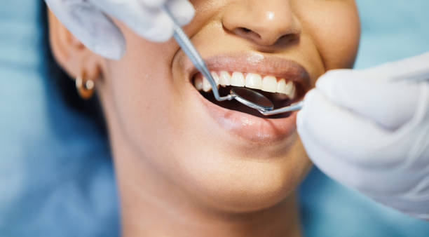 Best Broken or Chipped Tooth Repair in Markle, IN